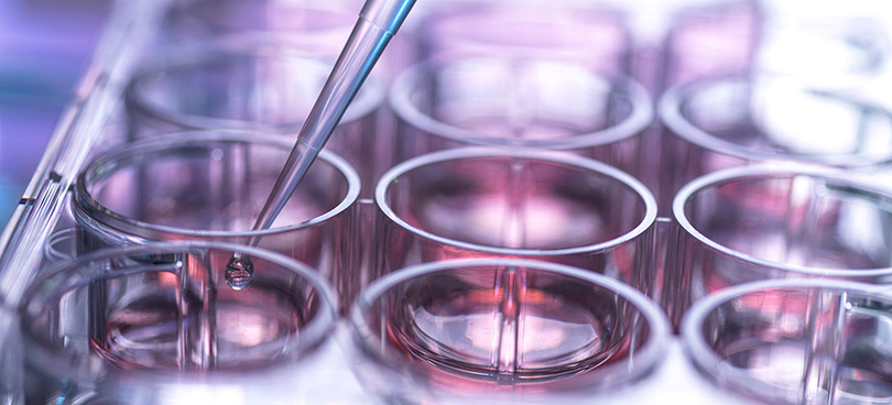 Close‑up of laboratory pipettes dispensing liquid into a clear multi‑well plate, illustrating scientific research and testing in the life sciences sector.